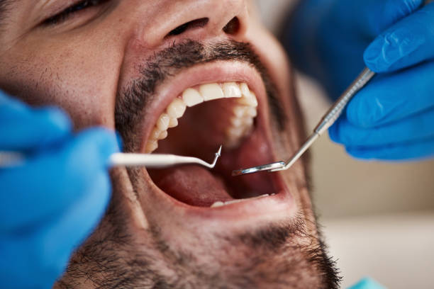 Best Emergency Treatment for Jaw Pain or Injury in The Villages, FL